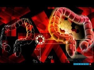 Новое в Ихилове: безоперационное лечение диабета и ожирения