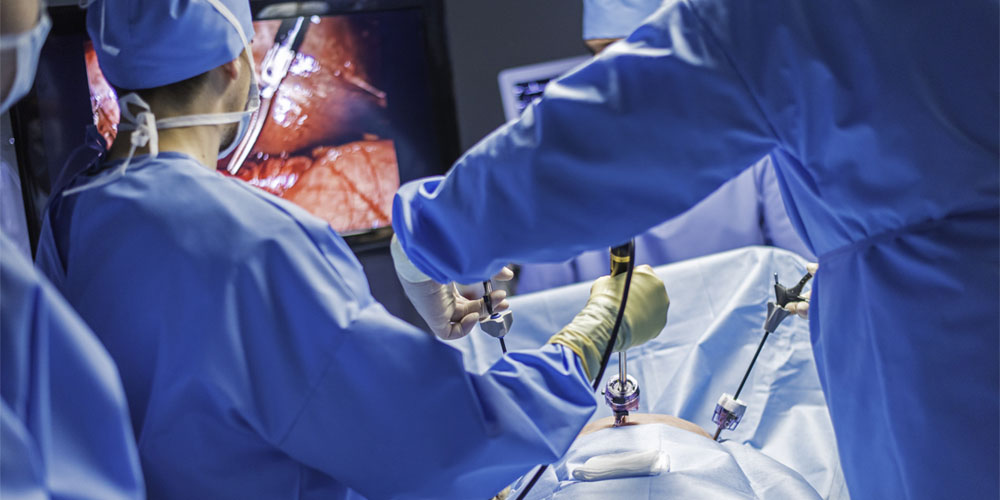 Эндоскопическая операция лапароскопическим методом