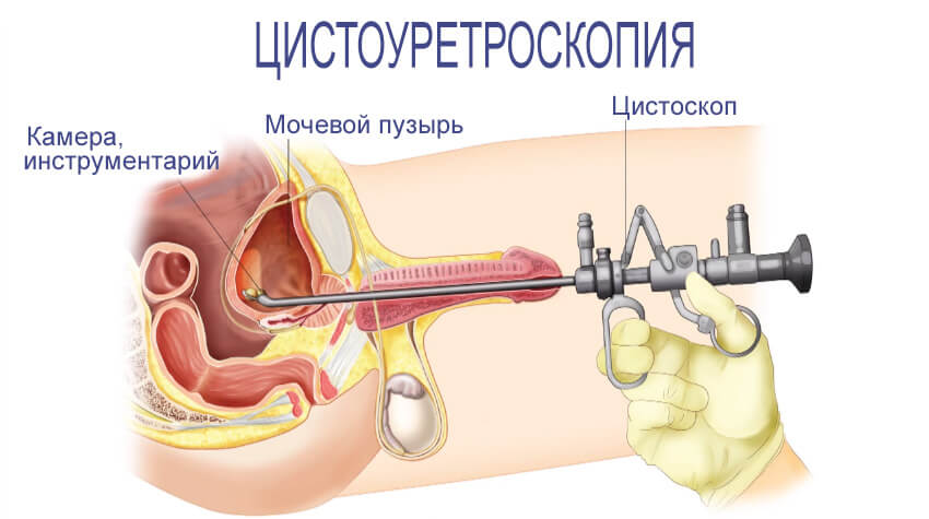 Диагностическая урология в Израиле