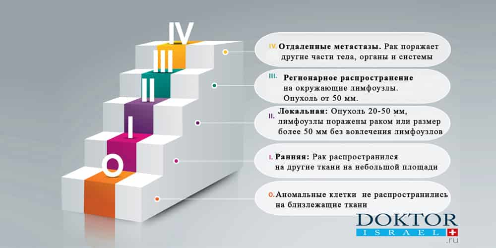 Лечение рака 4 стадии в Израиле