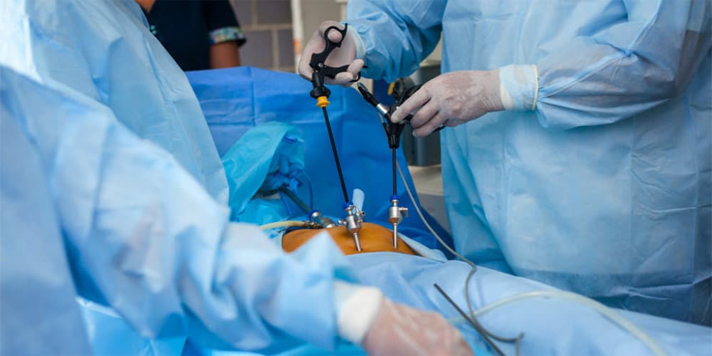 Эндоскопическая хирургия опухоли желудка за границей